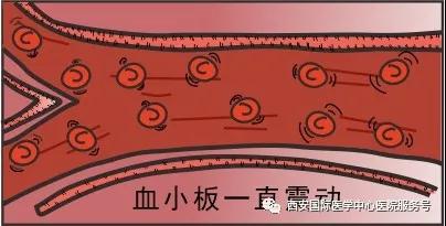 血小板是正常值的三倍？專家提醒小心血栓和出血！