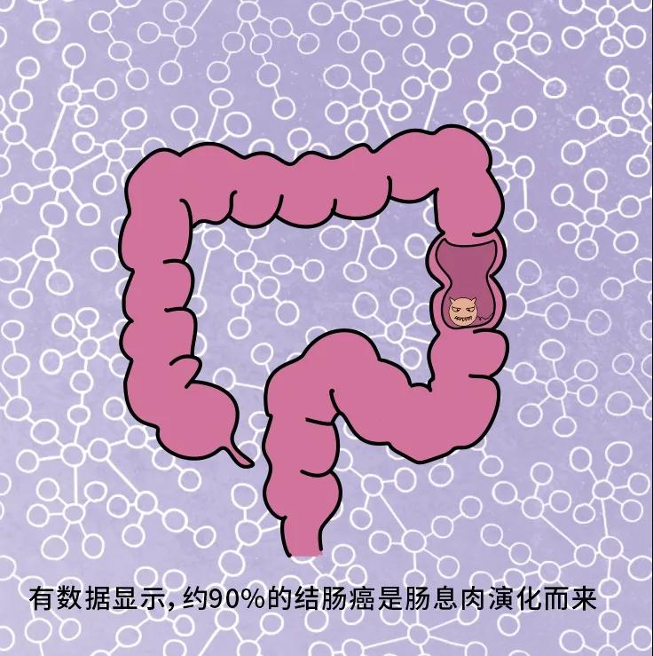 奪走“黑豹”生命的結(jié)腸癌，到底什么來頭？