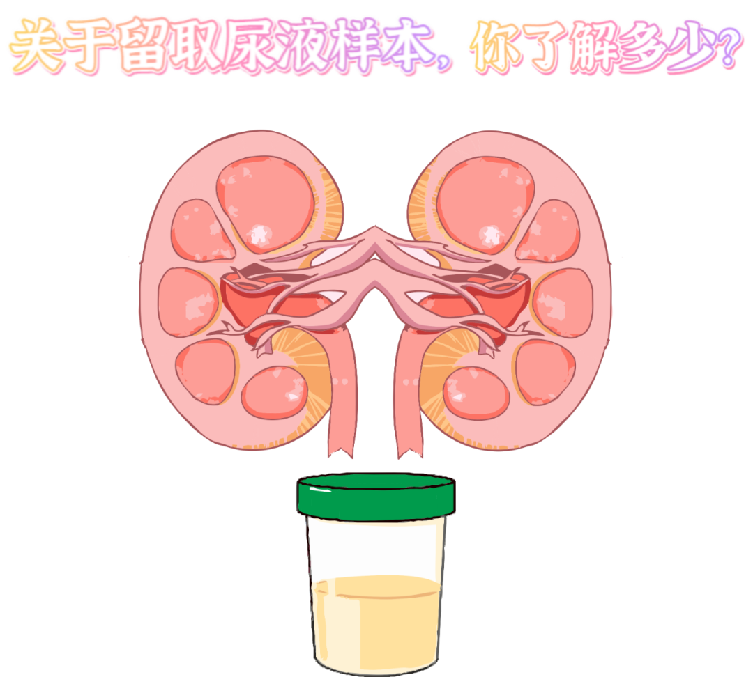 做尿檢，不得不說(shuō)的注意事項(xiàng)！
