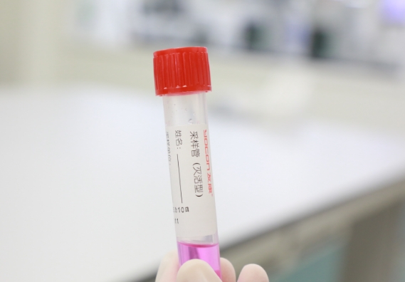 支原體感染檢測手段知多少？